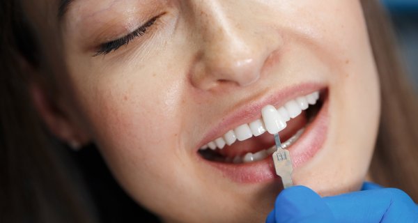 Estética dental en Andújar