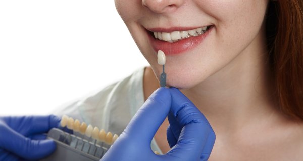 Odontología general en Andújar